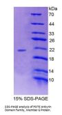 Human POTE Ankyrin Domain Family, Member G (POTEG) Protein