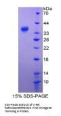 Human Transcription Factor p65 / NFKB3 (RELA) Protein