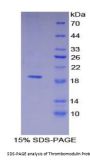 Human Thrombomodulin (THBD) Protein