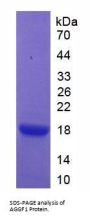 Human Angiogenic Factor With G Patch And FHA Domains 1 (AGGF1) Protein