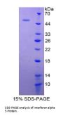 Human Interferon Alpha 5 (IFNa5) Protein