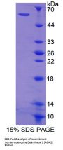 Human Adenosine Deaminase 2 (ADA2) Protein