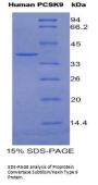 Human Proprotein Convertase Subtilisin/Kexin Type 9 (PCSK9) Protein