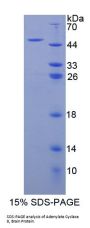 Human Adenylate Cyclase Type 8 (ADCY8) Protein