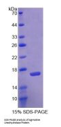Human Agmatine Ureohydrolase (AGMAT) Protein
