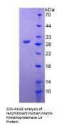 Human Matrix Metalloproteinase 14 (MMP14) Protein