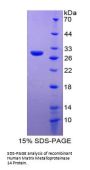 Human Matrix Metalloproteinase 14 (MMP14) Protein