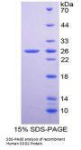 Human Superoxide Dismutase 2 (SOD2) Protein