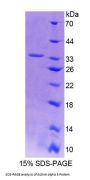 Human Actinin Alpha 3 (ACTN3) Protein