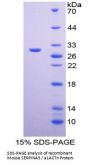 Mouse Serine Protease Inhibitor A3N (SERPINA3N) Protein