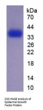 Mouse Epidermal Growth Factor (EGF) Protein