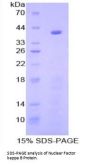 Mouse Nuclear Factor Kappa B (NFkB) Protein