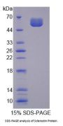 Mouse Sclerostin (SOST) Protein