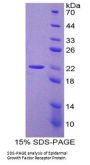 Mouse Epidermal Growth Factor Receptor (EGFR) Protein