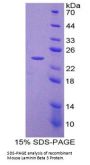 Mouse Laminin Beta 3 (LAMb3) Protein