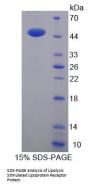 Mouse Lipolysis Stimulated Lipoprotein Receptor (LSR) Protein