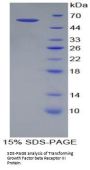 Mouse Transforming Growth Factor Beta Receptor III (TGFbR3) Protein