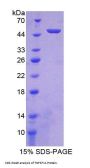 Mouse Tumor Necrosis Factor Ligand Superfamily Member 11 (TNFSF11) Protein