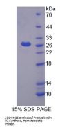 Mouse Hematopoietic Prostaglandin D Synthase (HPGDS) Protein