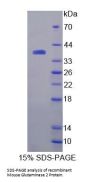 Mouse Glutaminase 2 (GLS2) Protein