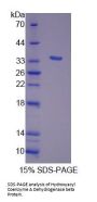 Mouse Hydroxyacyl Coenzyme A Dehydrogenase Beta (HADHb) Protein