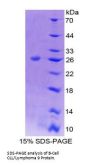 Mouse B-Cell CLL/Lymphoma 9 (Bcl9) Protein