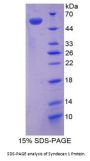 Mouse Syndecan 1 (SDC1) Protein