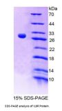 Mouse Interleukin 9 Receptor (IL9R) Protein