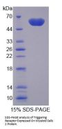 Mouse Triggering Receptor Expressed On Myeloid Cells 2 (TREM2) Protein