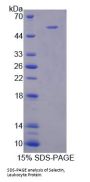 Mouse L-Selectin / CD62L (SELL) Protein