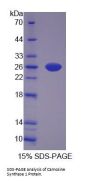 Mouse Carnosine Synthase 1 (CARNS1) Protein