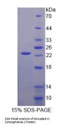Mouse Disrupted In Schizophrenia 1 (DISC1) Protein