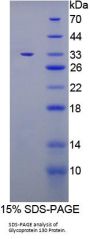 Mouse Glycoprotein 130 (gp130) Protein