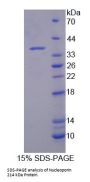 Mouse Nucleoporin 214 kDa (NUP214) Protein