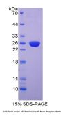 Mouse Fibroblast Growth Factor Receptor 4 (FGFR4) Protein