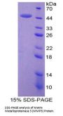 Mouse Matrix Metalloproteinase 3 / Stromelysin-1 (MMP3) Protein