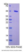Mouse Serum Amyloid A-2 Protein (SAA2) Protein