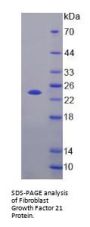Mouse Fibroblast Growth Factor 21 (FGF21) Protein