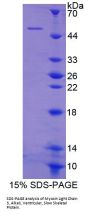 Mouse Myosin Light Chain 3 (MYL3) Protein