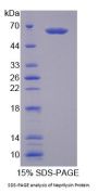 Mouse Neprilysin / NEP (MME) Protein