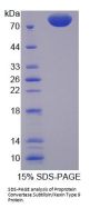 Mouse Proprotein Convertase Subtilisin/Kexin Type 9 (PCSK9) Protein
