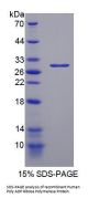 Human Poly ADP Ribose Polymerase 1 (PARP1) Protein