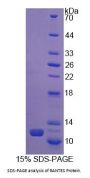Pig Regulated On Activation In Normal T-Cell Expressed And Secreted (RANTES) Protein