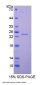 Pig Neutrophil Gelatinase Associated Lipocalin / NGAL (LCN2) Protein