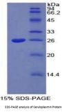 Rat Ceruloplasmin (CP) Protein