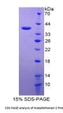Rat Metallothionein-2 (MT2) Protein