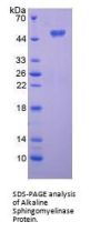 Rat Ectonucleotide Pyrophosphatase/Phosphodiesterase Family Member 7 (ENPP7) Protein