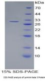Rat Laminin Beta 3 (LAMb3) Protein