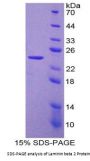 Rat Laminin Beta 2 (LAMb2) Protein