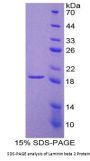 Rat Laminin Beta 2 (LAMb2) Protein